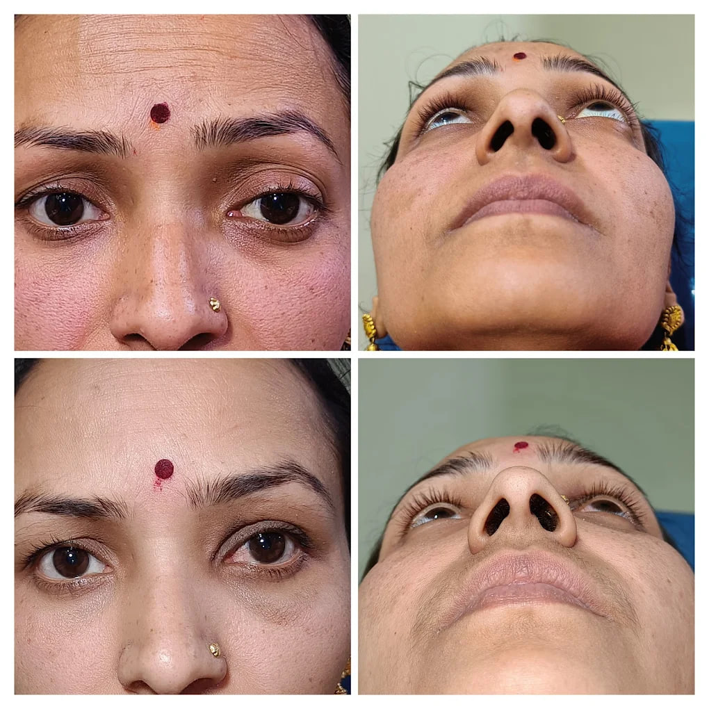 Clinical outcome case 1