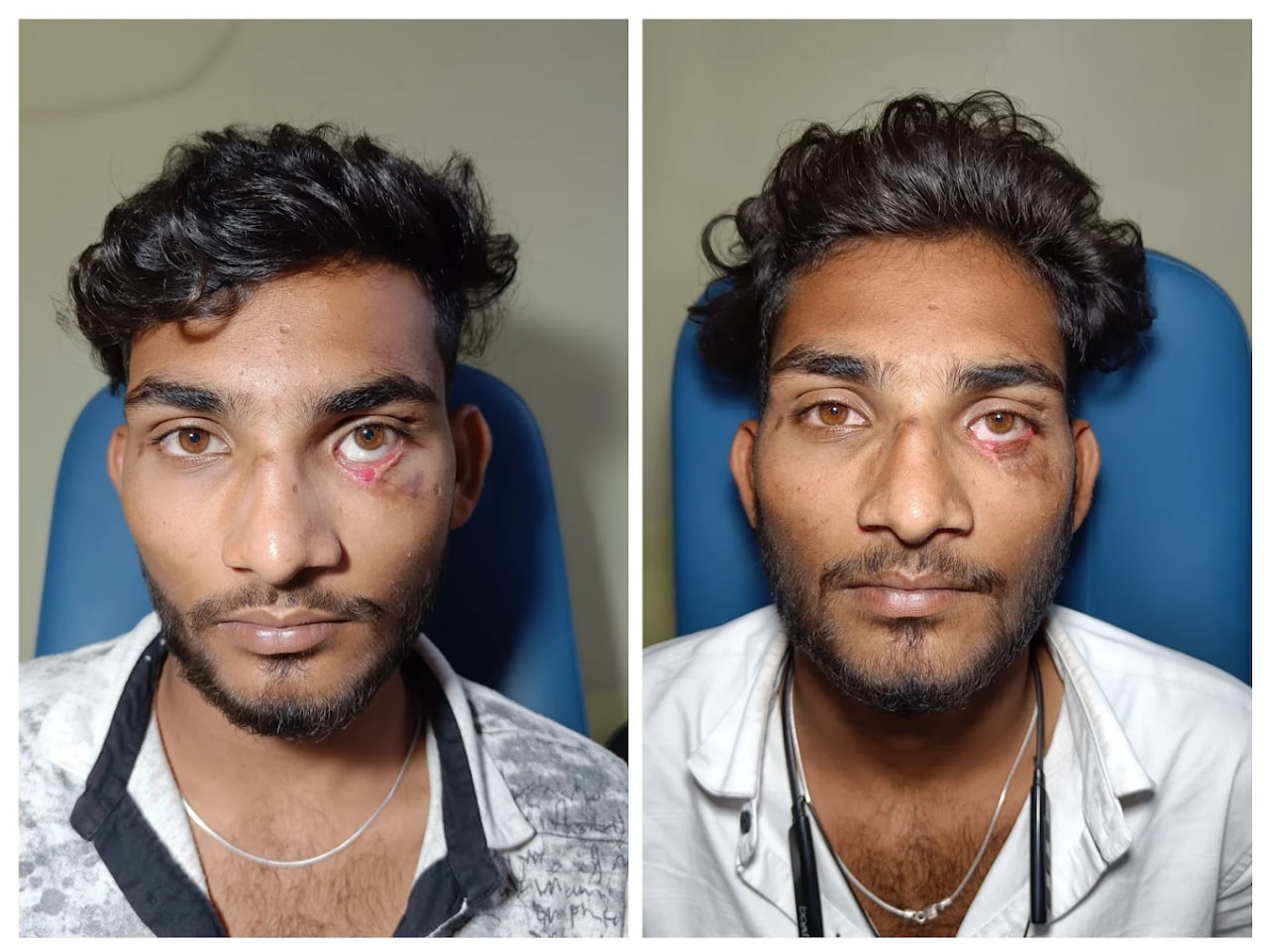 Clinical outcome case 2