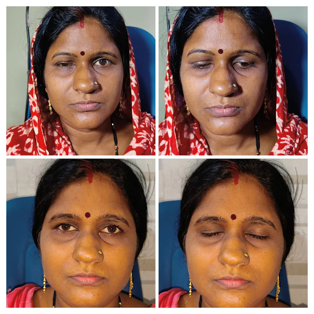 Clinical outcome case 3