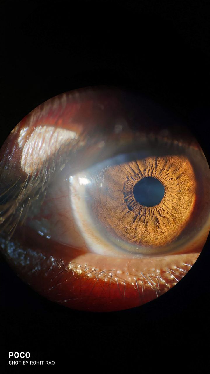 Eye care portrait visual